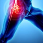 consult orthopod for hip injury