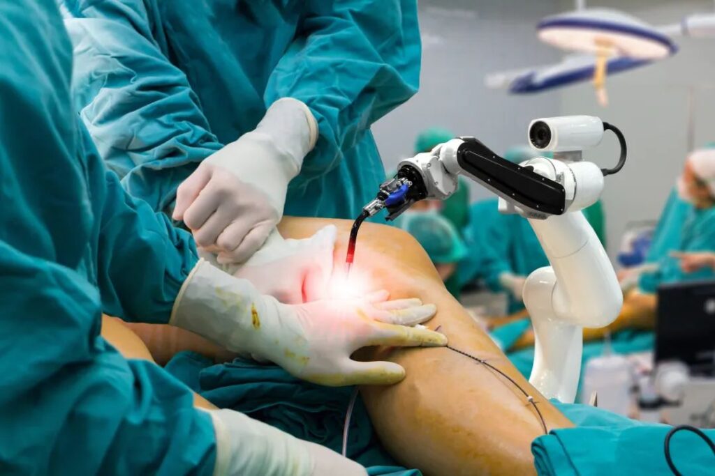 robotic knee replacement