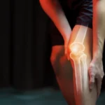 joint replacement surgery