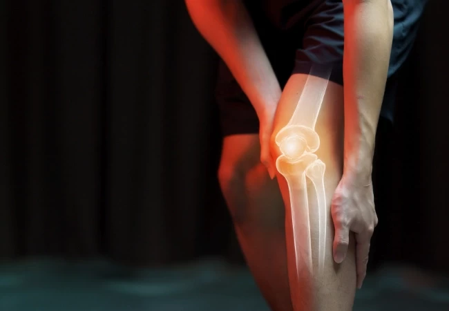 joint replacement surgery